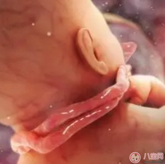 胎兒臍帶繞頸怎么辦？產(chǎn)前怎樣化解臍帶繞頸？