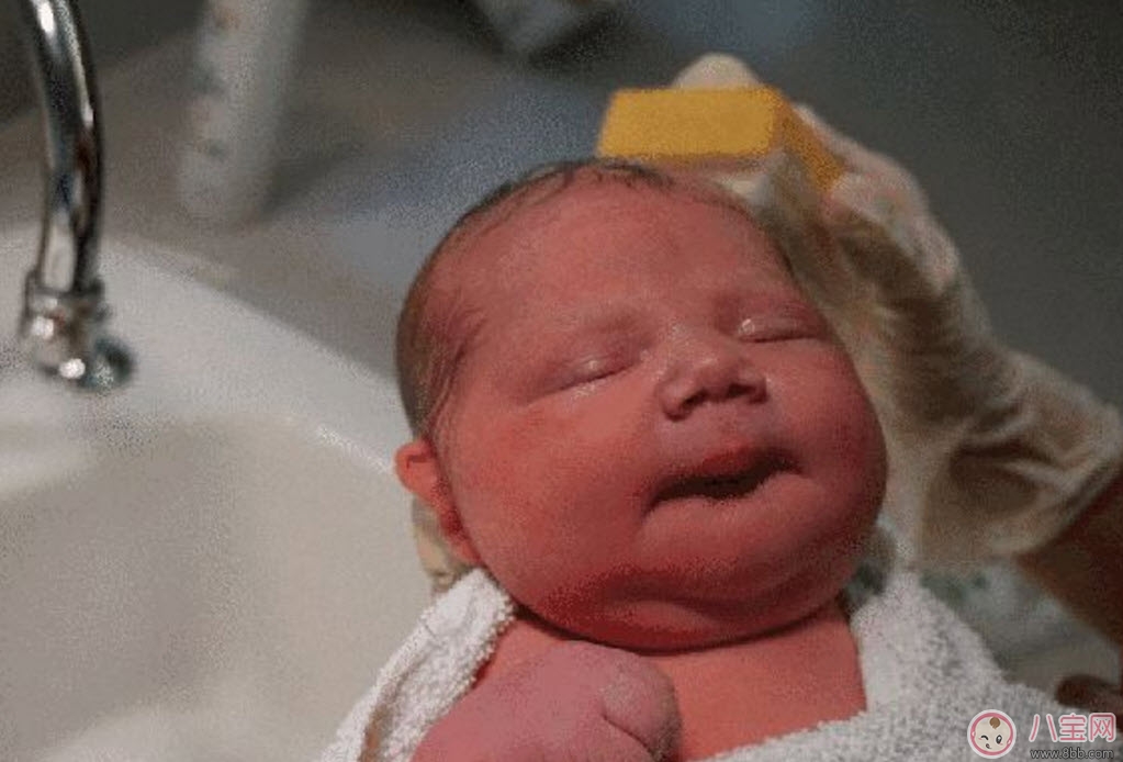 順產(chǎn)頭擠變形多久恢復(fù) 如何預(yù)防寶寶順產(chǎn)頭變形