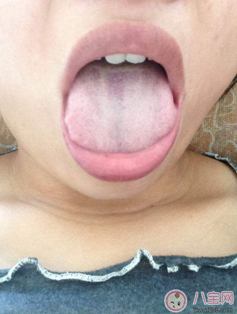 孩子脾虛的癥狀是什么 哪些情況是孩子脾虛了 孩子脾虛的癥狀是什么 哪些情況是孩子脾虛了